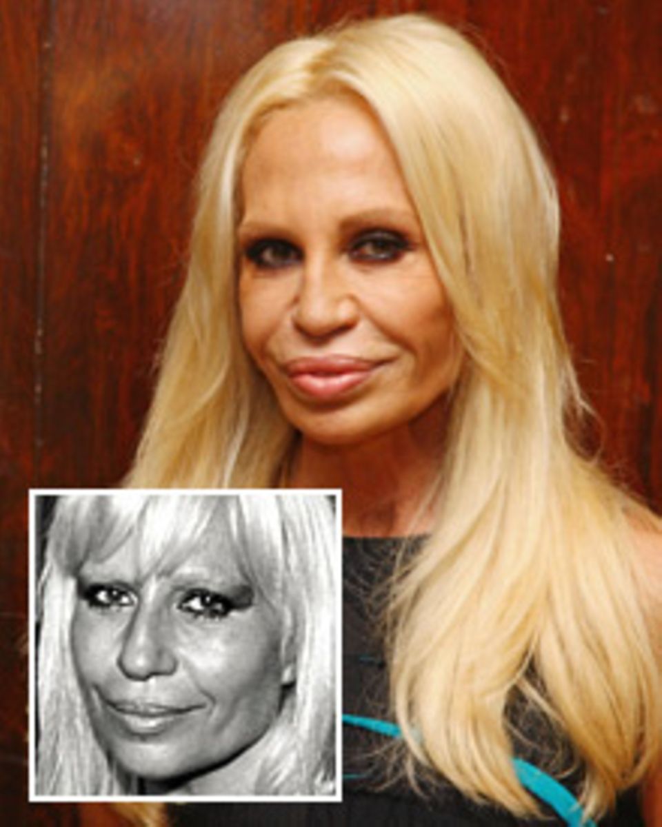 Bei der Designerin Donatella Versace, 54 erkennt Schönheitsexpertin Dr. Barbara Sturm "das typische Hollywood-Gesicht": starre Z