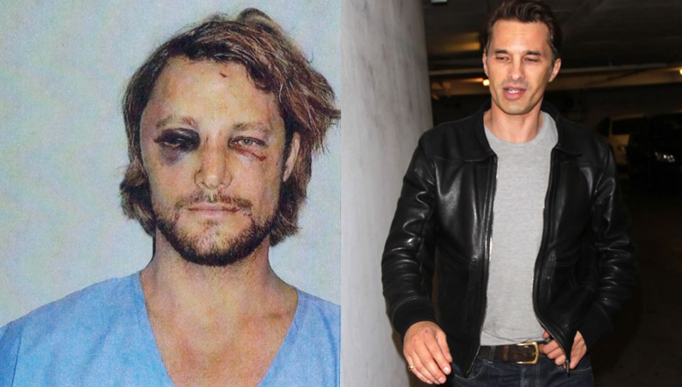 Gabriel Aubry weist nach der Attacke schwere Gesichtsverletzungen auf, Olivier Martinez dagegen sieht fast unversehrt aus. Der S