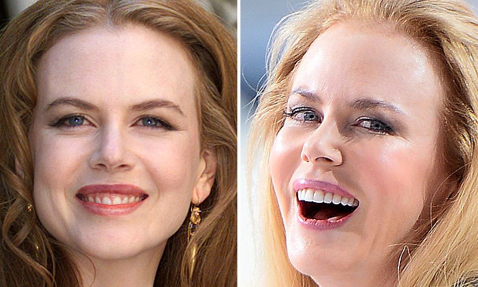 Nicole Kidman: Unglaubliche 15 Jahre liegen zwischen diesen beiden Aufnahmen: Nicole Kidman noch rothaarig im Jahr 1999 (links) und im Mai 2014 (rechts). Schwer vorstellbar, dass nur gute Gene für ihr jugendliches Aussehen verantwortlich sein sollen. Unglaubliche 15 Jahre liegen zwischen diesen beiden Aufnahmen: Nicole Kidman noch rothaarig im Jahr 1999 (links) und im Mai 2014 (rechts). Schwer vorstellbar, dass nur gute Gene für ihr jugendliches Aussehen verantwortlich sein sollen.