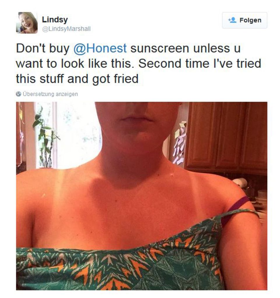 Eine wütende Userin lässt ihrem Ärger bei Twitter freien Lauf. Obwohl sie sich mit der Sonnencreme schützen wollte, erlitt Lindsy Marshall einen fiesen Sonnenbrand.
