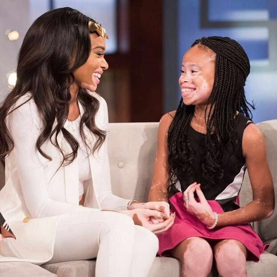 Vitiligo: Ein Traum wird wahr: In der amerikanischen Talkshow "The Real Daytime" traf April auf ihr Idol Winnie Harlow Ein Traum wird wahr: In der amerikanischen Talkshow "The Real Daytime" traf April auf ihr Idol Winnie Harlow