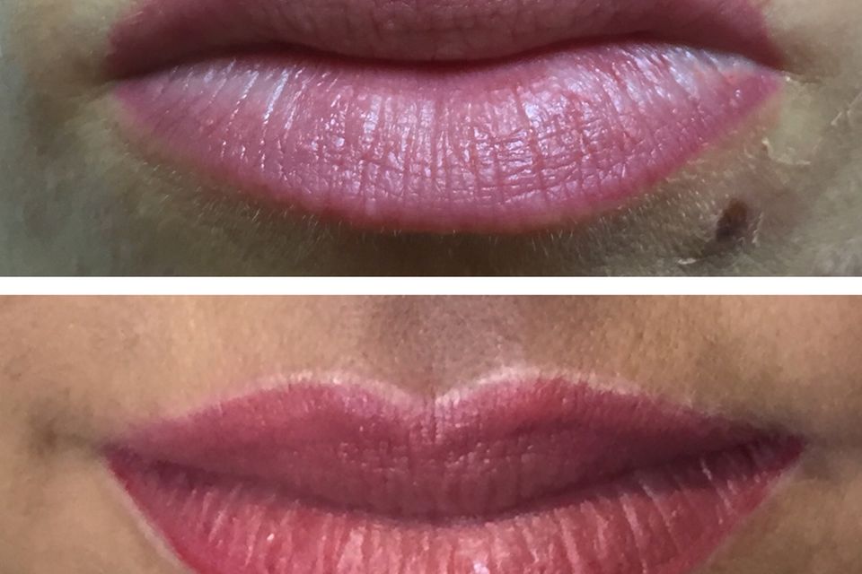 Sophia Wollersheim: Sophias Lippen im Vorher-Nachher-Vergleich: Nach der Behandlung (unten) sehen die Umrisse ihrer Lippen sichtlich definierter und sauberer verarbeitet aus. Sophias Lippen im Vorher-Nachher-Vergleich: Nach der Behandlung (unten) sehen die Umrisse ihrer Lippen sichtlich definierter und sauberer verarbeitet aus.