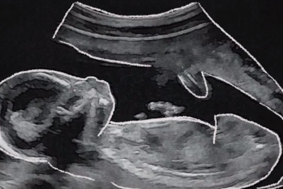 Dieses Ultraschallbild ist im Video der schwangeren Sängerin zu sehen.