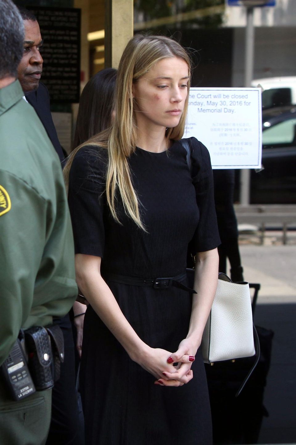 Amber Heard verlässt das Gerichtsgebäude in Los Angeles. In ihrem Gesicht sind blaue Flecken zu sehen.