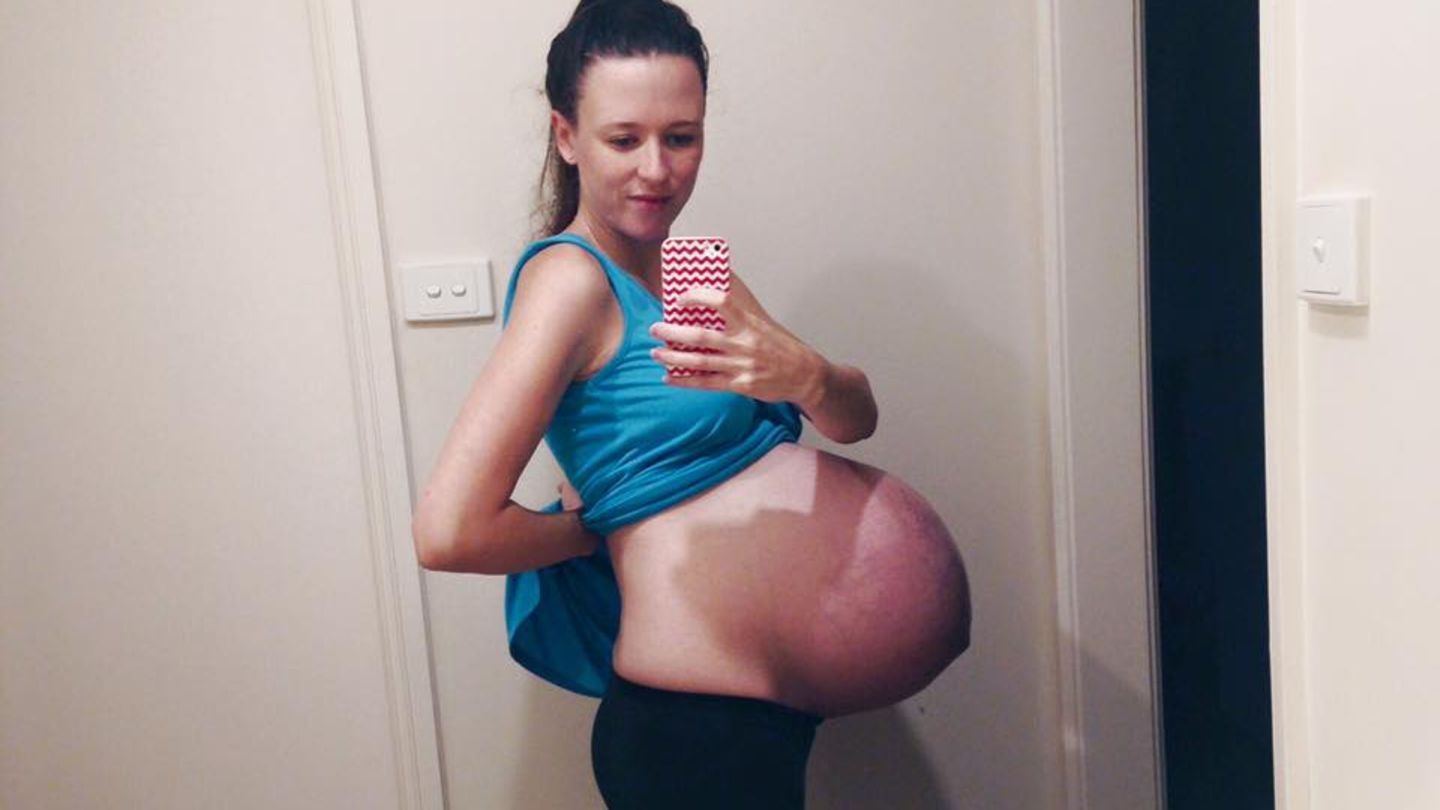 грудь и живот в первый месяц беременности фото 63