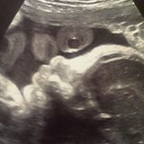 6. Dezember 2012  Stolz postet der werdende Vater das erste Bild seines noch ungeborenen Kindes.