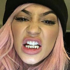 Wer wie Kylie Jenner so gar nicht mehr weiß, wohin mit dem Geld, kann sich ein maßgeschneidertes Exemplar goldener Grillz mit Brillantverzierung kaufen. Kann man aber auch getrost lassen.