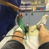 Und während die deutsche Nationalmannschaft in Brasilien alles gibt, wird Marco Reus seinen Gips los.