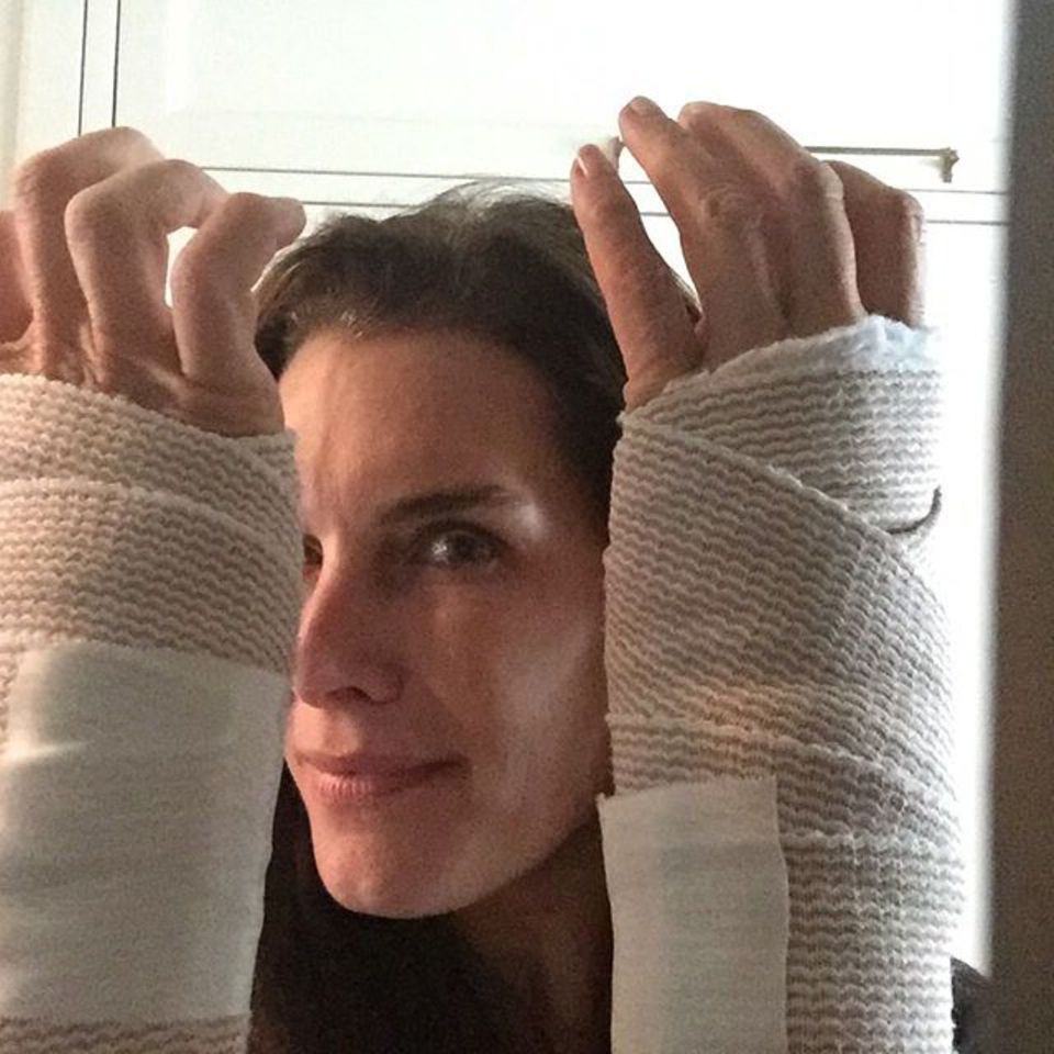 November 2015 Brooke Shields ist erleichtert: Wegen des sogenannten Karpaltunnelsyndroms, das ihr jahrelang Schmerzen verursacht hat, ist sie jetzt an beiden Handgelenken operiert worden. November 2015 Brooke Shields ist erleichtert: Wegen des sogenannten Karpaltunnelsyndroms, das ihr jahrelang Schmerzen verursacht hat, ist sie jetzt an beiden Handgelenken operiert worden.