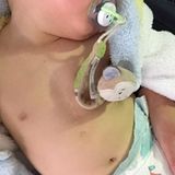 28. März 2016  Mit einem intimen Bild erinnert Sarah an die dramatische Herz-OP ihres Babys. "Jetzt bist du schon 9 Monate alt. Du bringst so viel Licht in unser Leben und hast uns gezeigt, was wirklich zählt im Leben ... Wir lieben dich so sehr ... Mit all deinen Narben, die zeigen, dass du stärker bist, als Mama und Papa es je sein könnten ... Unser Löwenherz", schreibt sie zu der Aufnahme, auf der Alessios Narben zu sehen sind.
