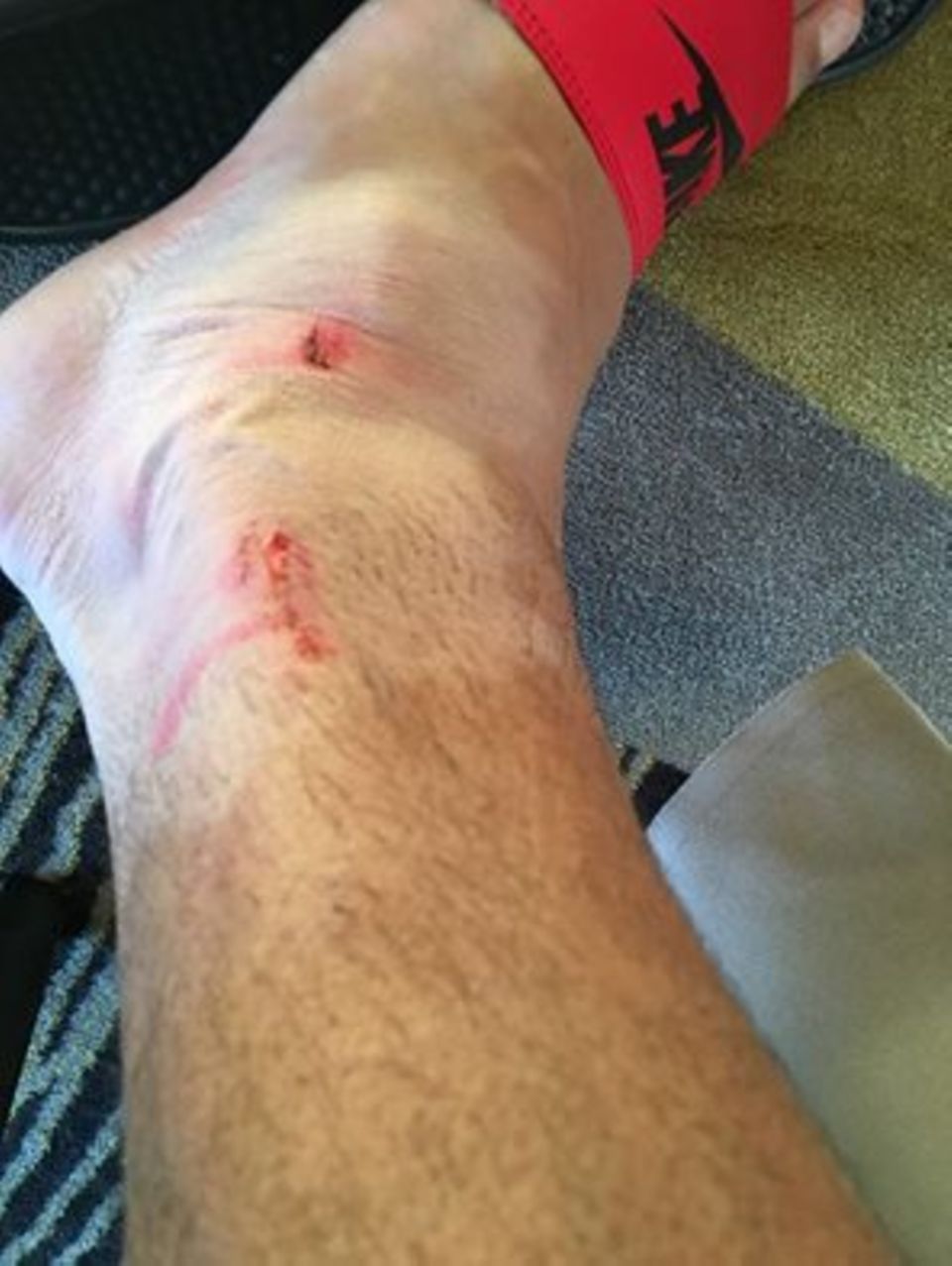 Zu diesem Bild schreibt Sami Khedira auf Facebook: "Ein kleines "Andenken" aus der 1. Halbzeit gegen Polen... Wir müssen jetzt weiter hart kämpfen, um 3 Punkte im nächsten Spiel einzufahren".