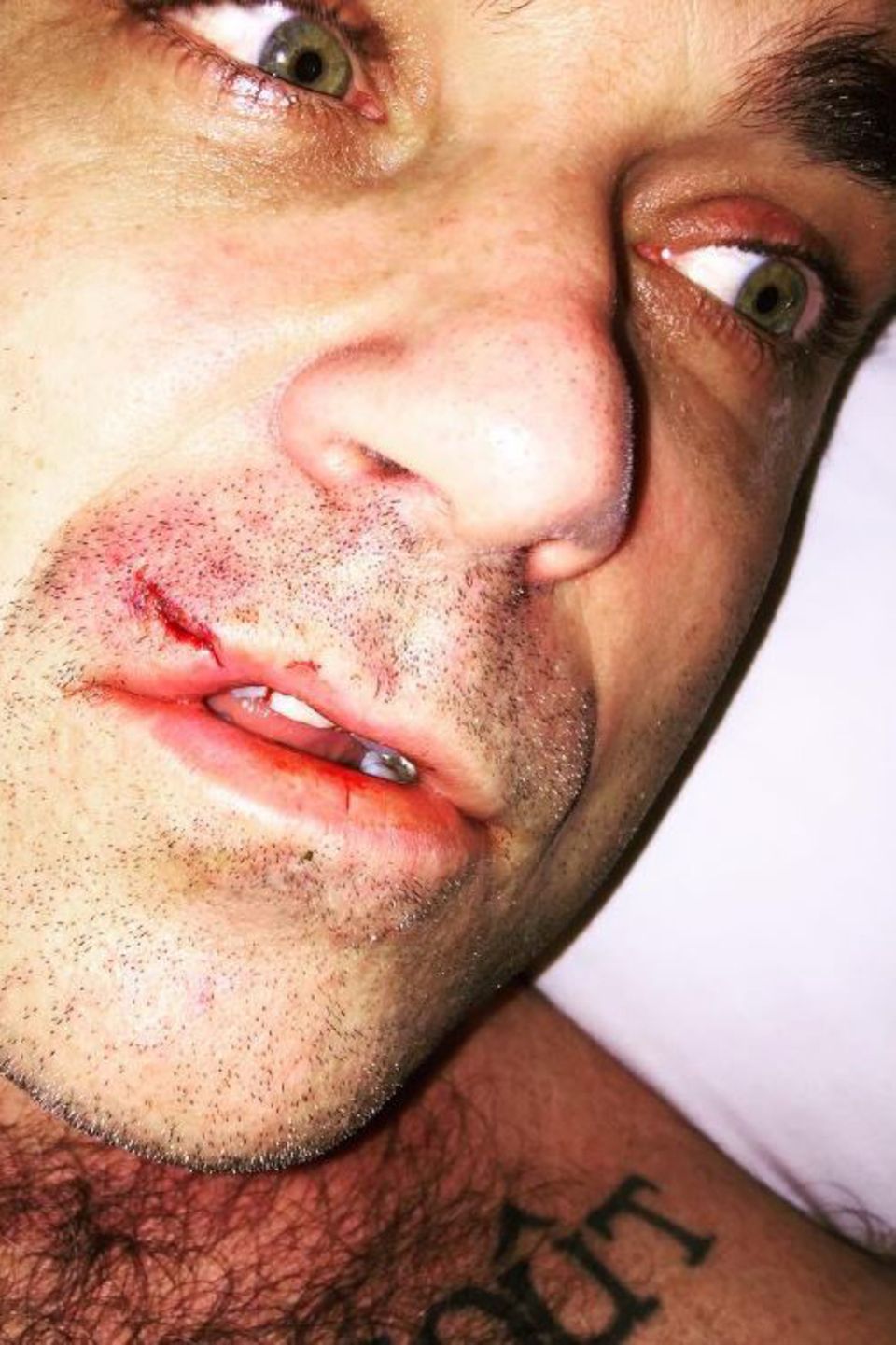 Januar 2017 Nein, es ist nicht häusliche Gewalt. Robbie Williams hatte nur eine Auseinandersetzung mit seinem Computer gehabt und der Computer hat gewonnen. Die Verletzung trägt er natürlich mit Würde. 