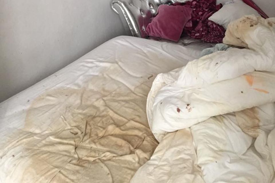 Schock Für Zara! Anzeigen Wegen "Ausgemergelt Und Ungesund Dünn" Gestoppt – Diese Bilder Schockieren! - xc1ht3q