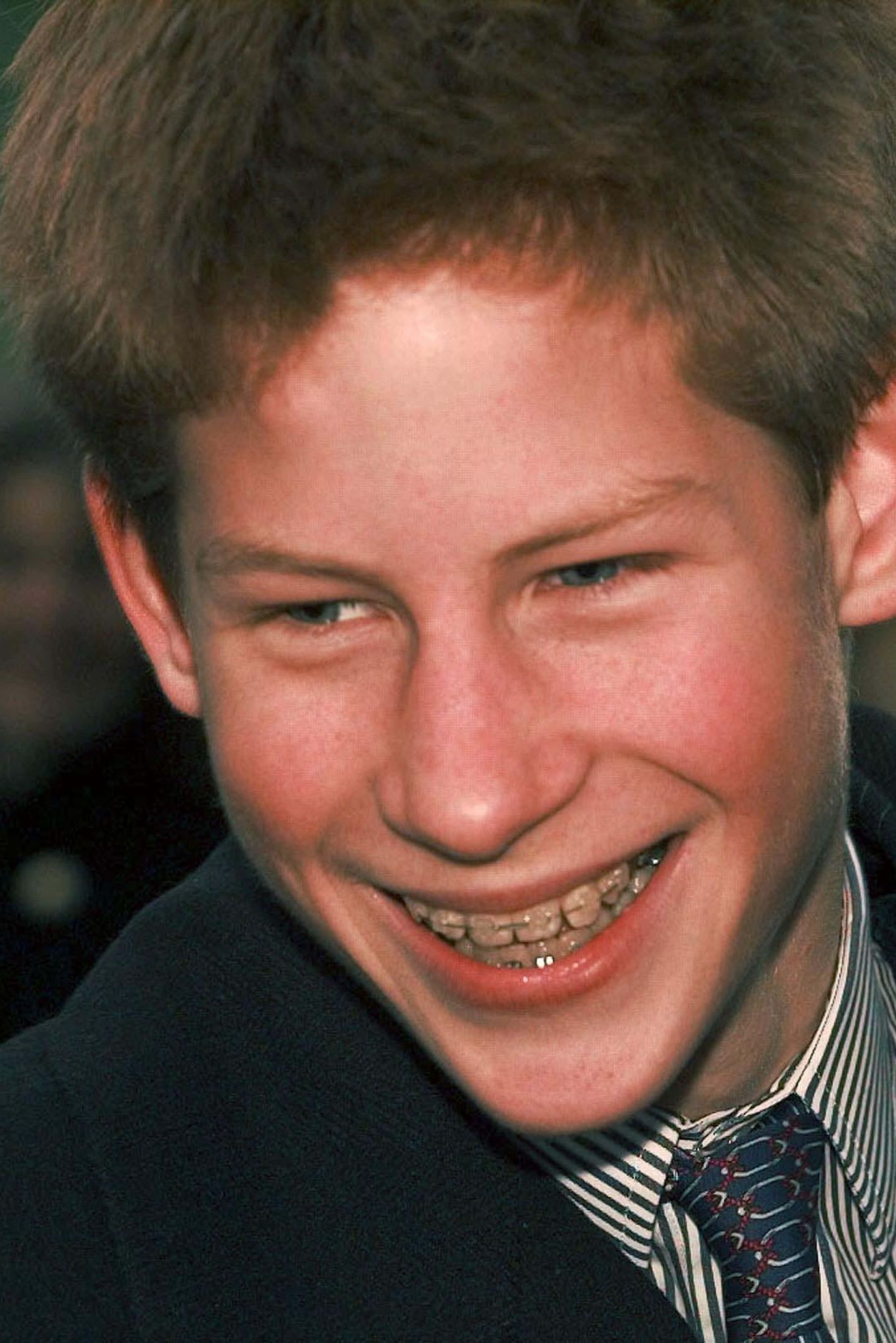 1999  Als Teenager muss Prinz Harry eine feste Zahnspange tragen - mit Erfolg. Heute sind seine Zähne absolut gerade und lückenlos.