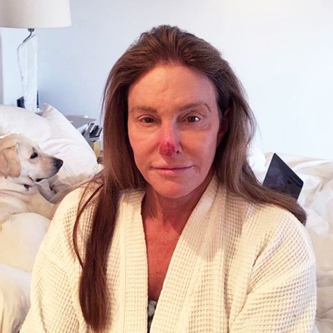 Caitlyn Jenner