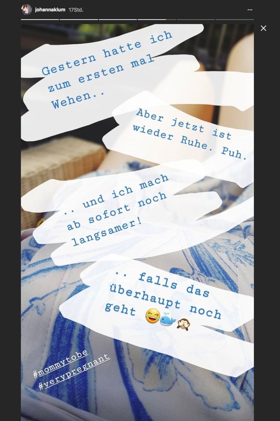 In der Instagram-Story teilte Johanna Klum mit, dass sie zwei Monate vor dem errechneten Geburtstermin wehen hatte. In der Instagram-Story teilte Johanna Klum mit, dass sie zwei Monate vor dem errechneten Geburtstermin wehen hatte.