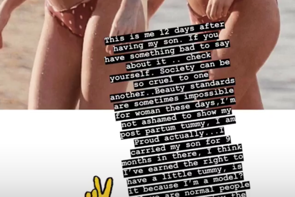 Candice Swanepoel: In ihrer Instagram-Story postet Candice Swanepoel am 11. Juli ein klares Statement und Bikini-Fotos von sich. "Ich habe das Recht dazu, einen kleinen Bauch zu haben", schreibt sie und beschwert sich über heutige Schönheitsideale. In ihrer Instagram-Story postet Candice Swanepoel am 11. Juli ein klares Statement und Bikini-Fotos von sich. "Ich habe das Recht dazu, einen kleinen Bauch zu haben", schreibt sie und beschwert sich über heutige Schönheitsideale.