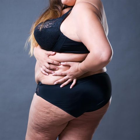 Frau mit Übergewicht (Symbolbild) 