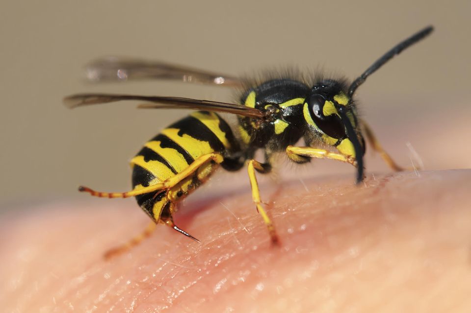 Anaphylaktischer Schock: Wie Gefährlich Ist Das? | GALA.de