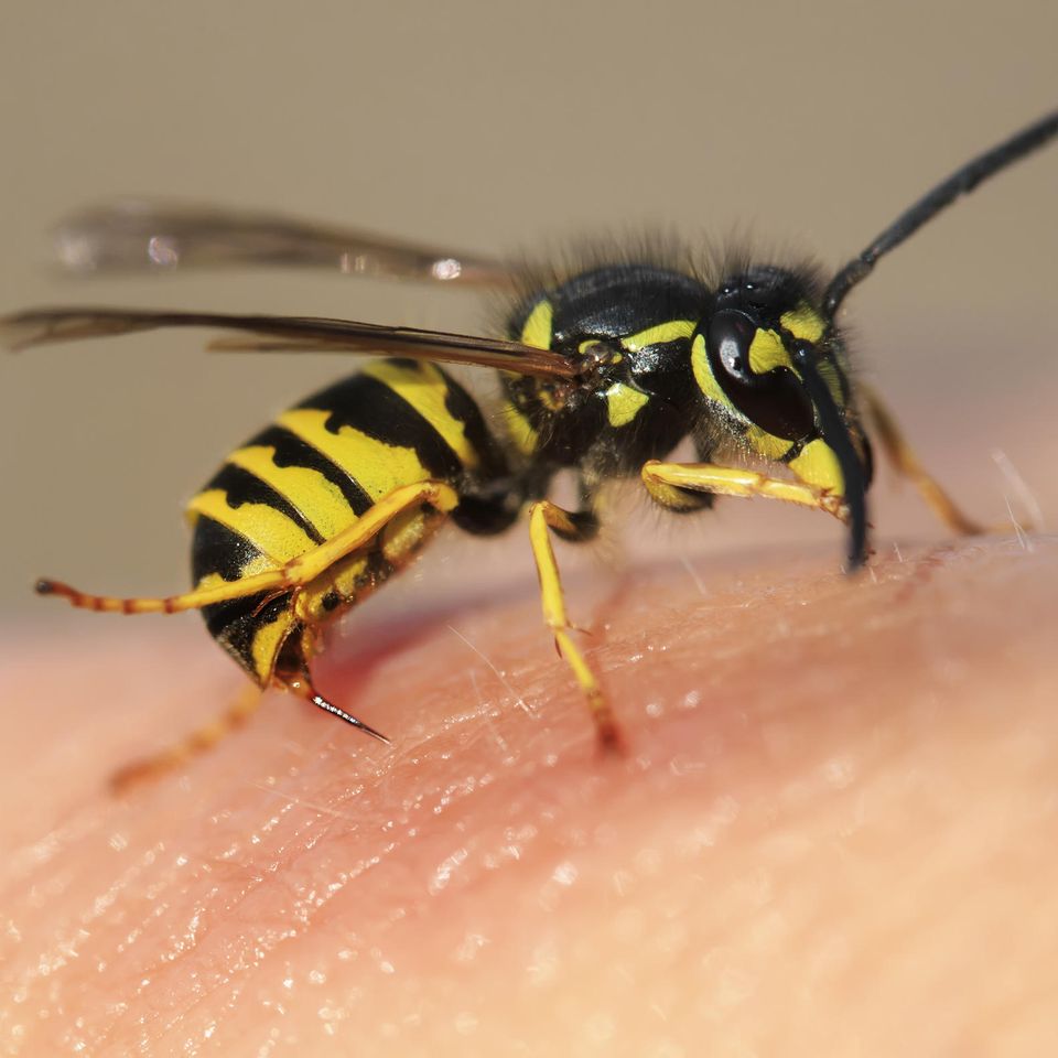 Ein anaphylaktischer Schock (allergischer Schock) kann durch einen Insektenstich ausgelöst werden
