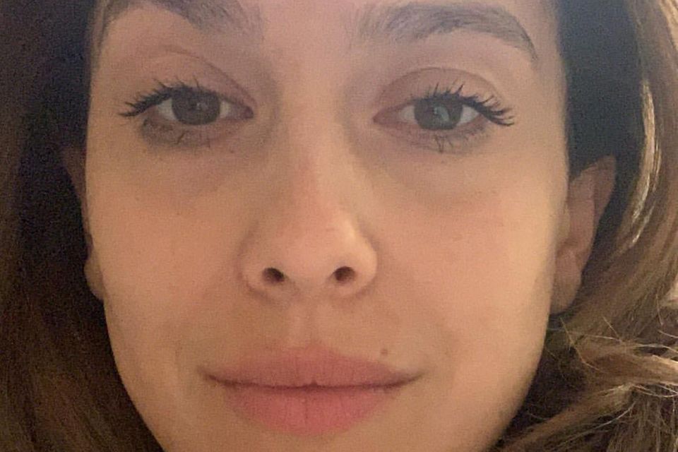 Hilaria Baldwin: Nach der Ausschabung meldet sich Hilaria Baldwin auf Instagram. Nach der Ausschabung meldet sich Hilaria Baldwin auf Instagram.