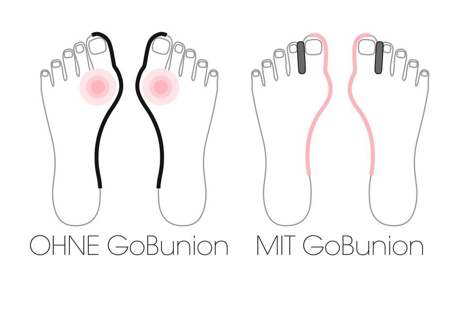 GoBunion, Zehenspreizer, Hallux-Socken GoBunion, Zehenspreizer, Hallux-Socken