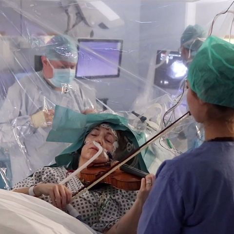 Dagmar Turner spielt während ihrer Gehirnoperation Geige.