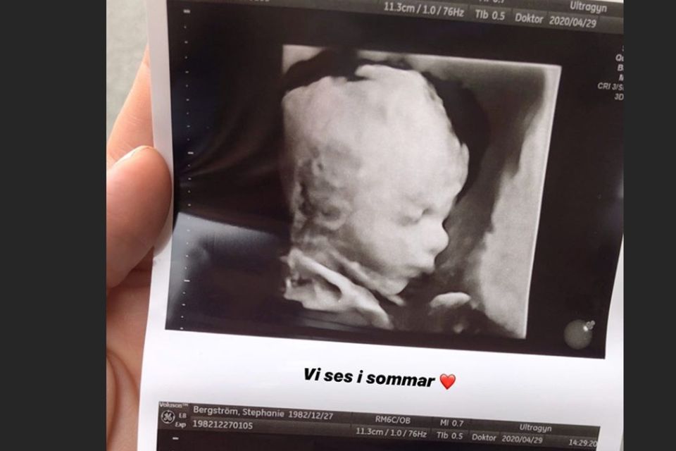 Stephanie Bergström zeigt Ultraschallfotos ihres dritten Kindes.