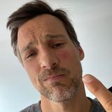 9. Juni 2020  Autsch, das hat wehgetan, vielleicht hilft da etwas Eis zur Kühlung? Florian David Fitz schaut bekümmert. Eine Wespe hat sich unter seine Brille verirrt und vor lauter Panik zugestochen.