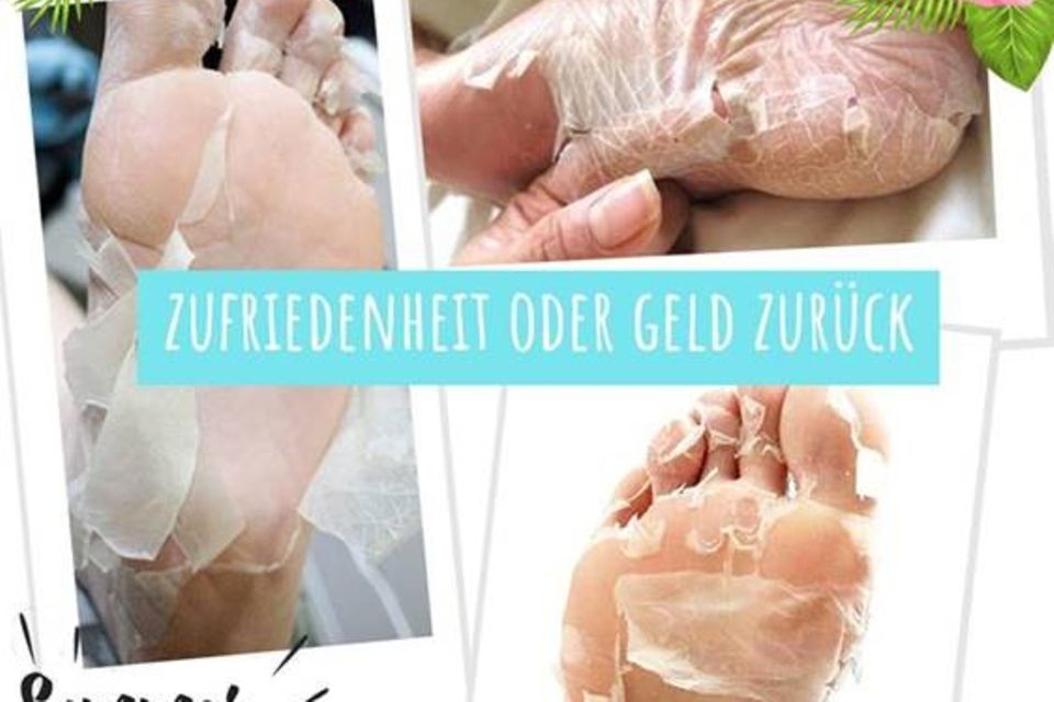Effekt der Summer Foot Fußmaske bei der Hornhautentfernung Effekt der Summer Foot Fußmaske bei der Hornhautentfernung