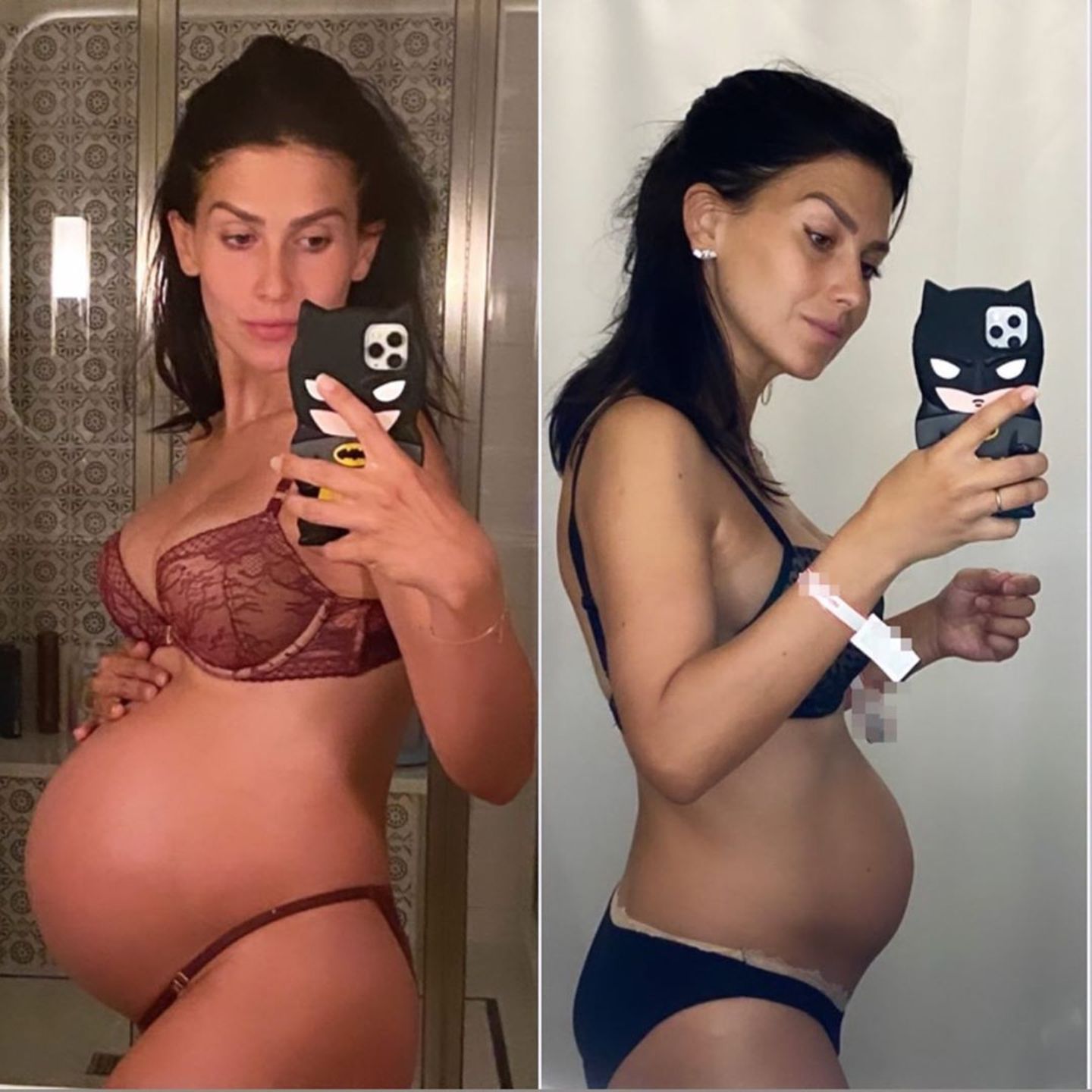 Vorher figur wie nach schwangerschaft ᐅ Hautrückbildung
