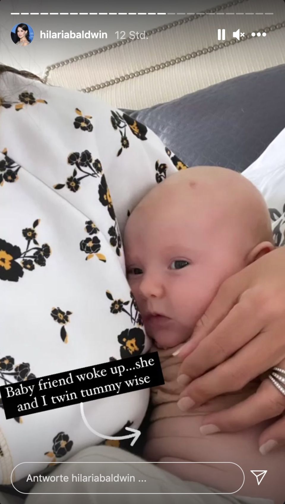 Hilaria Baldwin: Ehrliches Body-Update 7 Monate nach der Geburt Hilaria Baldwin: Ehrliches Body-Update 7 Monate nach der Geburt