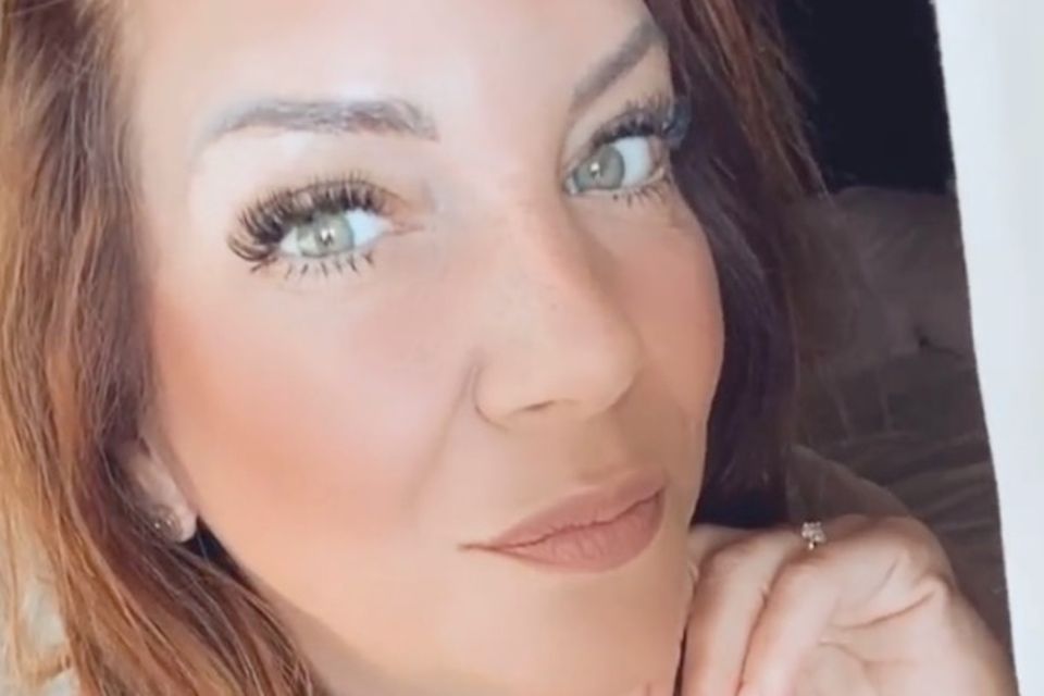 Danni Büchner Sie War Beim Beauty Doc Und Zeigt Das Ergebnis Galade 