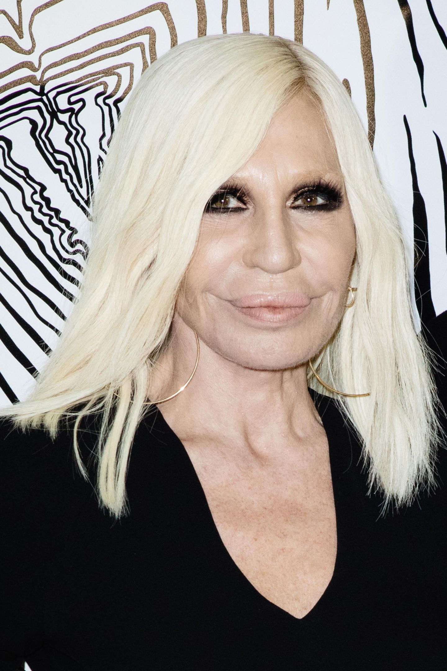 Donatella Versace  Botox, Cirurgia plastica, Cirurgias