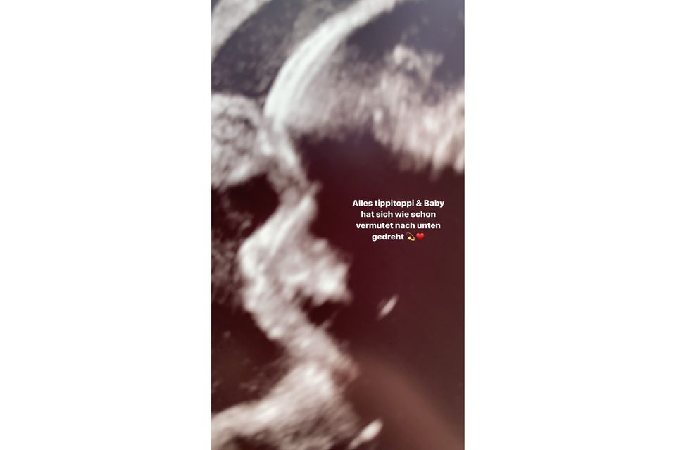 Baby-Check-up: Marie Nasemann veröffentlicht ein neues Ultraschallbild