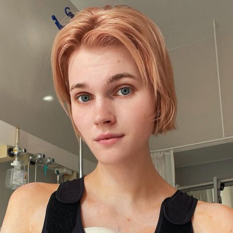 Model Lucy Hellenbrecht nach ihrer Brust-OP.
