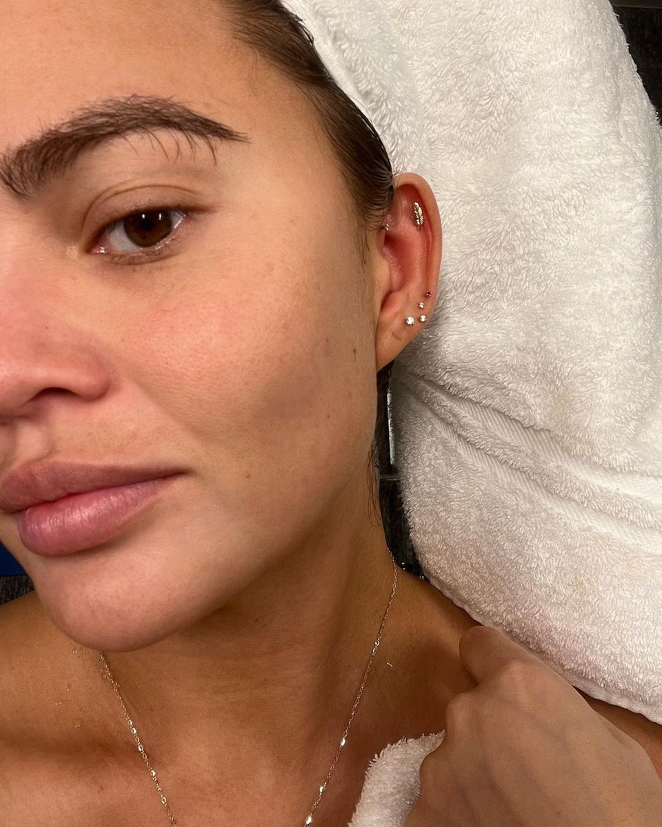 Vor einigen Monaten hat sich Topmodel Chrissy Teigen Haare von ihrem Kopf in ihre Augenbrauen transplantieren lassen. Nun zeigt der Eingriff Resultate. Mit buschigen und wild wachsenden Augenbrauen präsentiert sie sich ungeschminkt auf Instagram. "Ein Fluch und Segen, diese Augenbrauen. 10/10 würde es ich wieder tun", schreibt sie zufrieden zu ihren wilden Brauen. Vor einigen Monaten hat sich Topmodel Chrissy Teigen Haare von ihrem Kopf in ihre Augenbrauen transplantieren lassen. Nun zeigt der Eingriff Resultate. Mit buschigen und wild wachsenden Augenbrauen präsentiert sie sich ungeschminkt auf Instagram. "Ein Fluch und Segen, diese Augenbrauen. 10/10 würde es ich wieder tun", schreibt sie zufrieden zu ihren wilden Brauen.