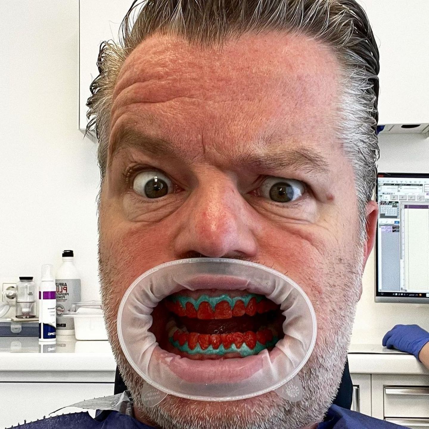 3. März 2023  "Ich war schon immer ein Großmaul!" kommentiert André Dietz selbstironisch dieses witzige Selfie, das er beim Zahnarzt geschossen hat. Er ist eben ein echter "Dentsetter".