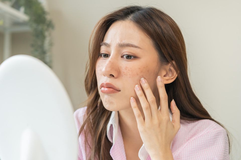 Fruchtsäurepeeling: 5 Produkte für weiche Haut | GALA.de