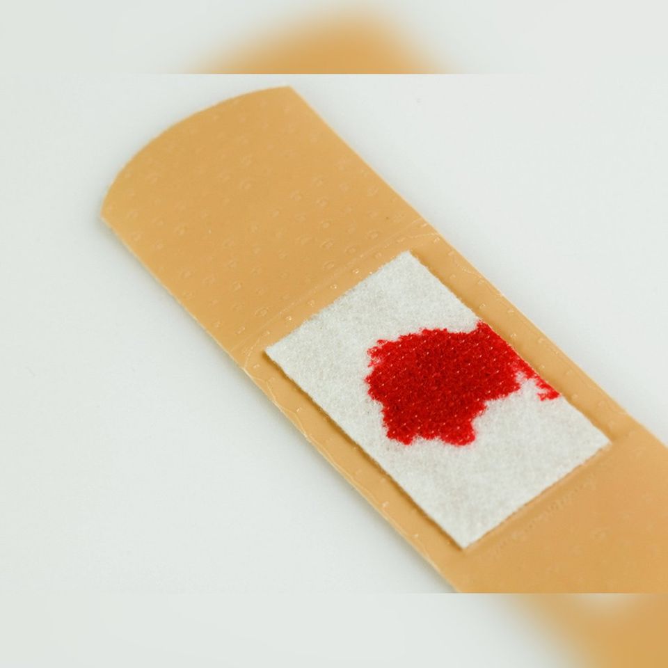 Eine Blutvergiftung wird häufig zu spät erkannt und kann dadurch lebensbedrohlich sein.