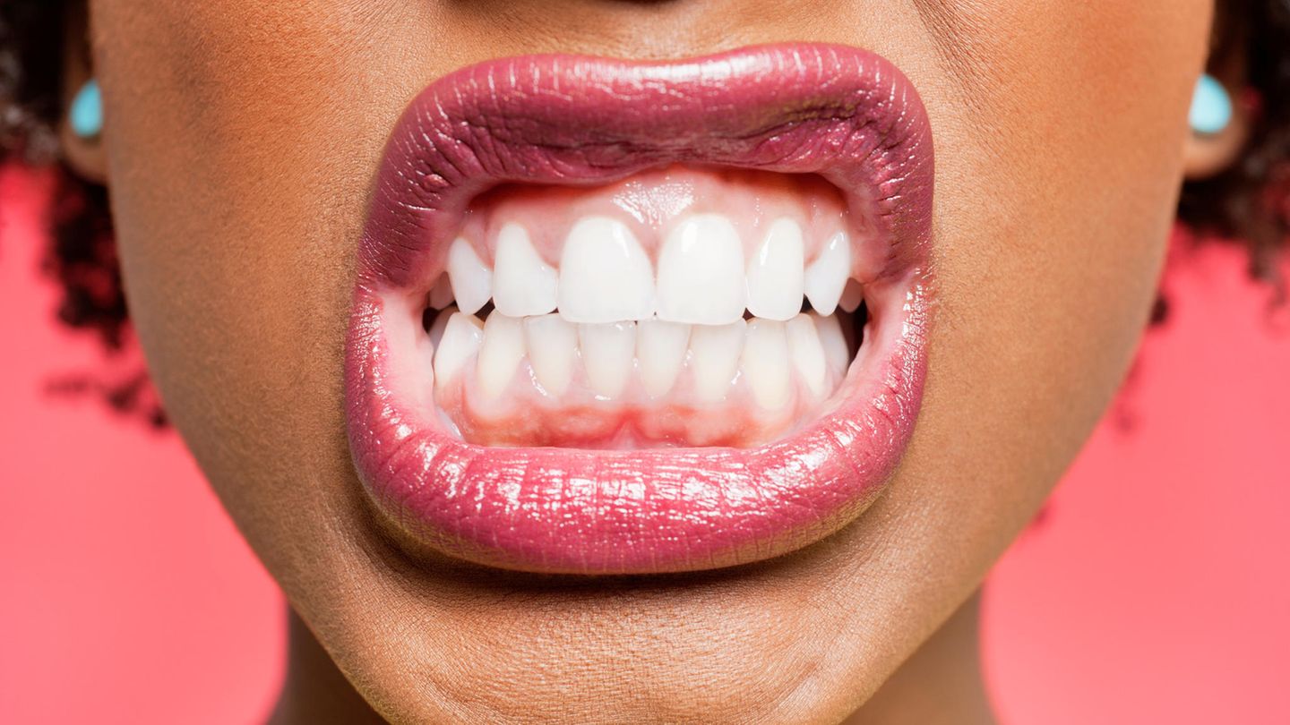 Traumdeutung Zähne Was bedeutet das? GALA.de