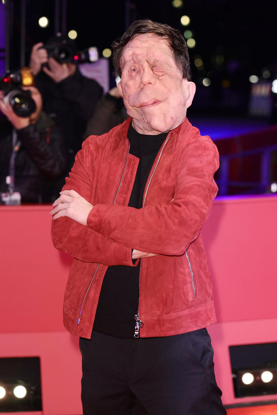 Entstellter BerlinaleStar Adam Pearson begeistert bei Premiere GALA.de