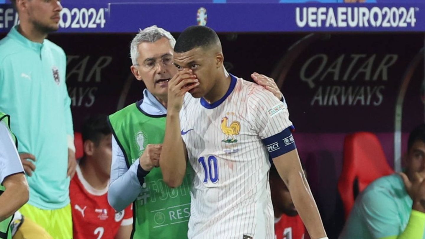 Fußballstar Kylian Mbappé: Er nimmt Nasenbeinbruch bei EM mit Humor