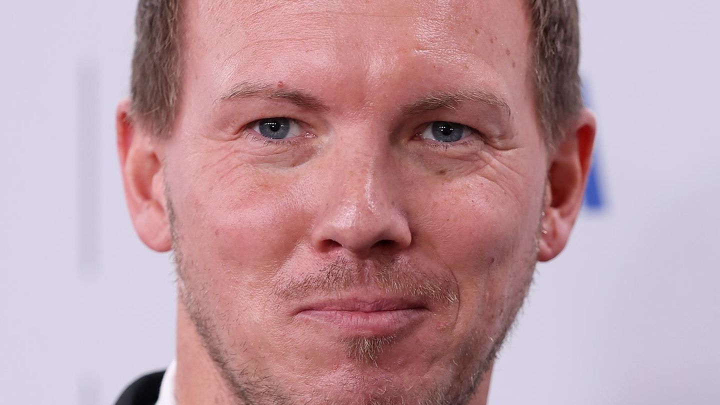 Schweinsteiger-Podolski-Co-So-sah-der-Ex-Bundestrainer-vor-seinen-Beauty-Operationen-aus