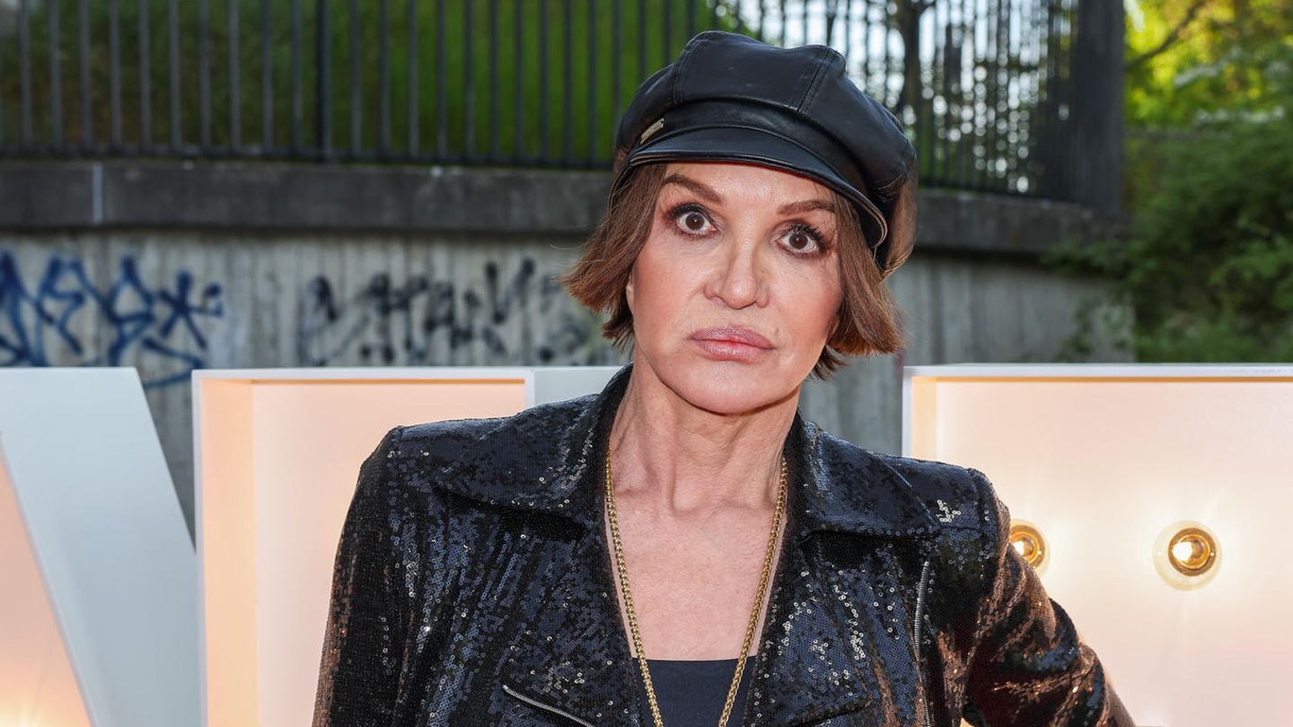 Stars im Beautywandel: Nicht wiederzuerkennen: So sah sie vor ihren Schönheitsoperationen aus