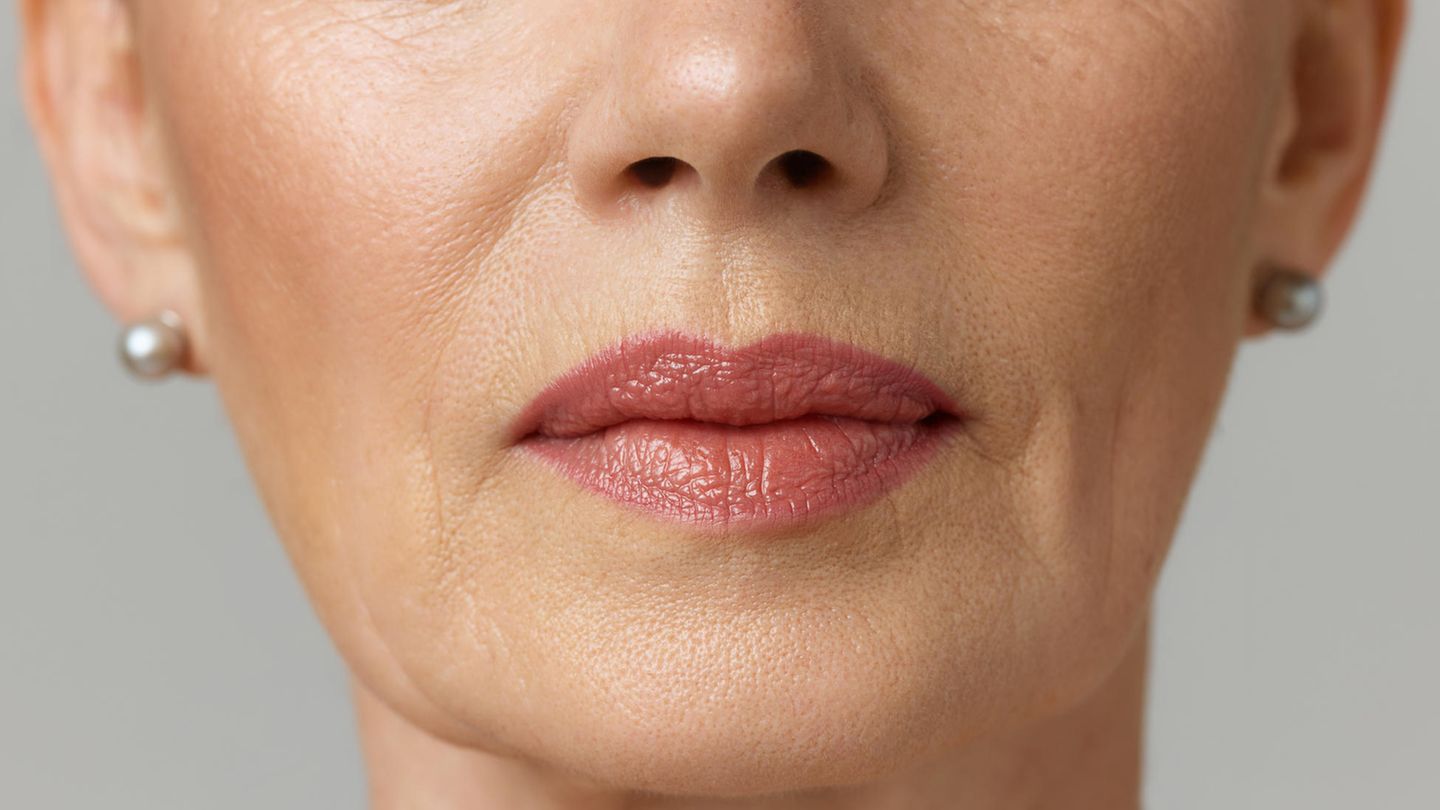 Thin lips in old age: Treat + prevent with 3 effective methods