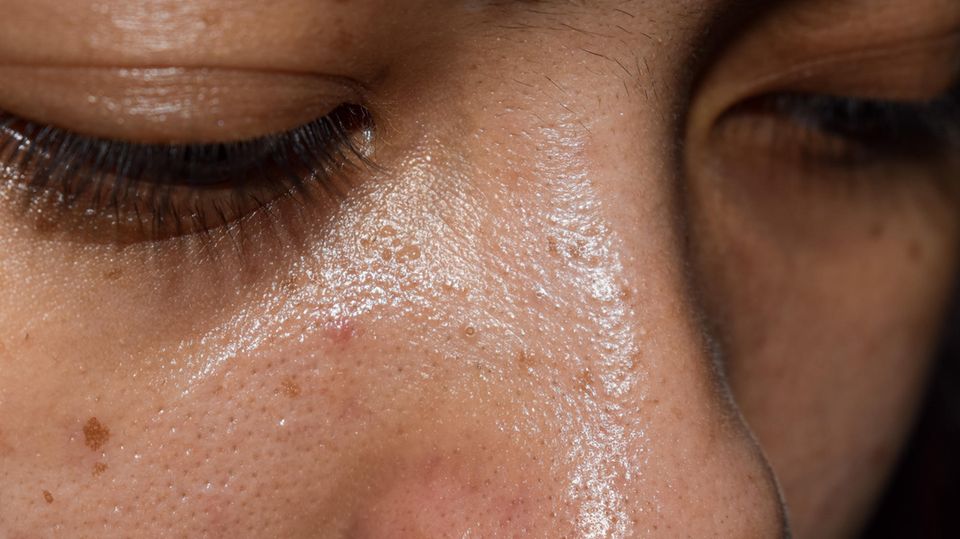 Aromatisches Wasser Bei Unreiner Haut – Pflegewasser Zur Beruhigung Und Reinigung