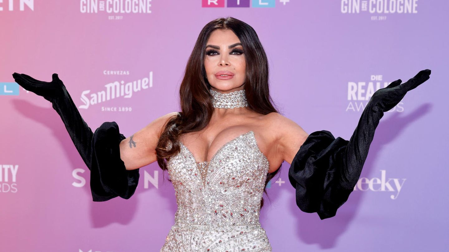 Botox-OPs-So-krass-hat-sie-sich-in-den-letzten-Jahren-ver-ndert
