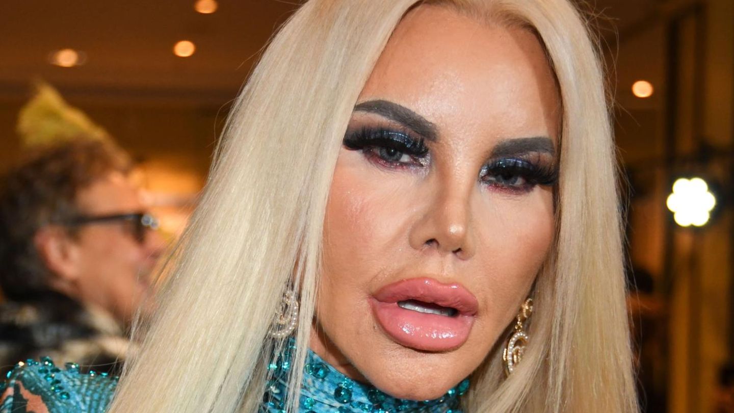 Stars Mit Botox Botox und Schönheits-OPs: Stars im Schönheitswahn | GALA.de
