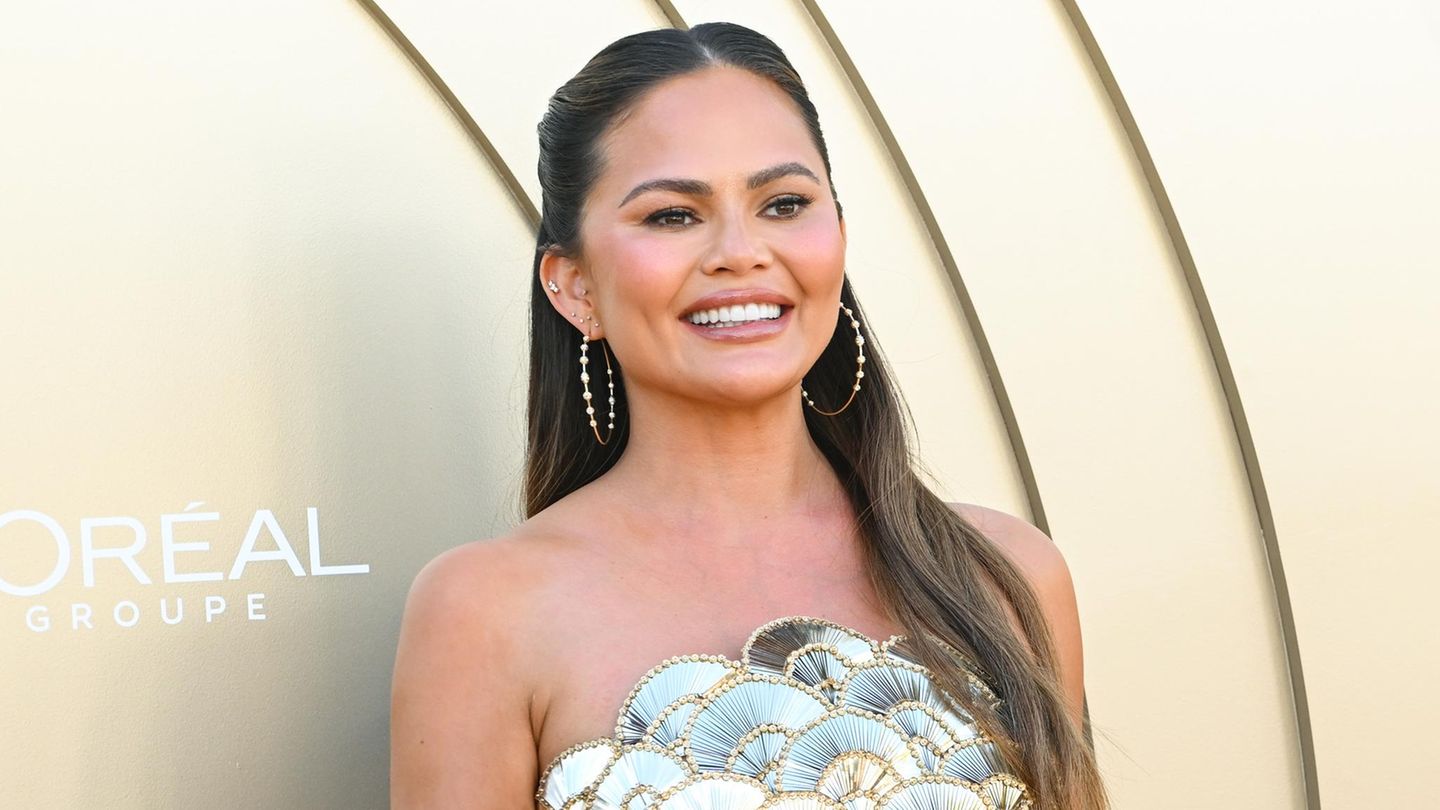 Chrissy Teigen Sie hat sich die Stirn verkleinern lassen GALA.de